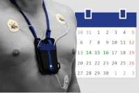 Individuelle Gesundheitsleistung: : EKG-Aufzeichnung über 72h zur Abklärung von Herzklopfen, Herzrasen und anderer Rhythmusstörungen.