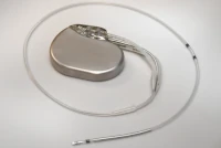 Herzcheck: Nachsorge von Herzschrittmachern, Defibrillatoren und Ereignisrekordern